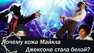 Почему кожа Майкла Джексона стала белой?