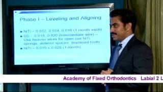 Orthodontic Mechanotherapy - Wire Sequence and Standard Operating Protocol