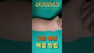 126. 오금 통증, 무릎 뒤쪽 통증 해결 방법(Popliteus)ㅣ한의학박사, 침구과전문의, 산청김, 김경태 원장| ft 부부한의사