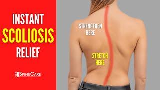 Best Scoliosis Exercises for Pain and Posture (NO EQUIPMENT!)