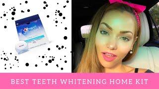 At home teeth whitening with great results | Juju Gurgel