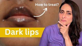 Dark Lips | How to treat | Dermatologist suggests