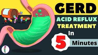 GERD Treatment | Acid Reflux Treatment | Heartburn Treatment - All You Need to Know