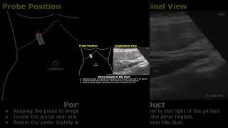 Caudate Lobe, Porta Hepatis, CBD Probe Positioning | Liver Ultrasound Transducer Placement |#shorts