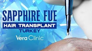 Sapphire FUE Hair Transplant Turkey #hairtransplant #sapphirefue #sapphirehairtransplant