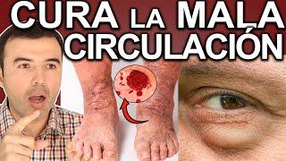 SOLUCIONA LA MALA CIRCULACIÓN - Como Mejorar La Circulacion Y Limpiar Las Arterias Y Venas