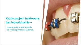 Ortodoncja Wodzisław Śląski Dental Med