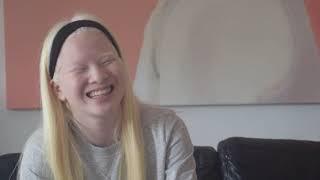 XUELI, 'My life with albinism' | Documentary