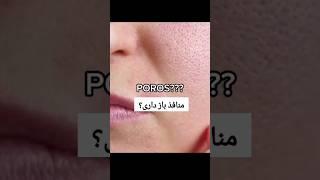 درمان معجزه بستن منافذ باز صورت در خانه /ماسک خانگی#shorts #shortvideo #زیبایی#ماسک#mask