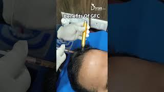 GFC Procedures and Benefits of GFC | Hair Fall Treatment