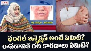 ఫంగల్ ఇన్ఫెక్షన్ అంటే ఏమిటి? రావడానికి గల కారణాలు ఏమిటి?  | What is a fungal infection? | CVR Health