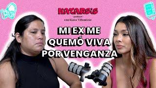 MI “EX PAREJA” ME QUEMÓ VIVA, la historia de KATHERINE GOMEZ contada por CINTHYA MACHARE, su mamá