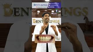 வெள்ளை நிற பற்கள் வேண்டுமா? How to get white teeth? Denta Kings Dr. Karthikeyan