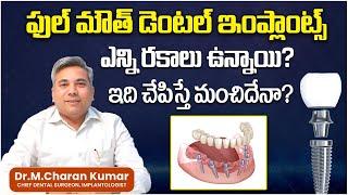 Teeth Implantation Process In Telugu || Full Mouth Dental Implants || Eledent Dental Hospitals