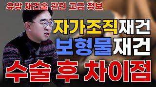 유방암이후 유방복원 자가재건 or 보형물재건 어떤게 더 좋을까?!