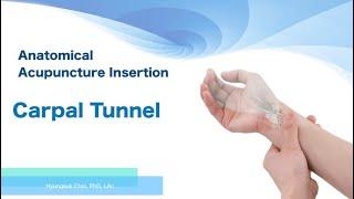 Anatomical Acupuncture for Carpal Tunnel, PC7