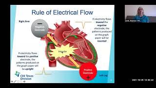 ECG Fundamental Recording