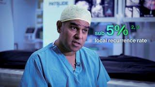 Quality Ablation with CAS-One IR | Dr. Nadeem Shaida