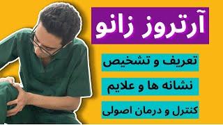 آرتروز زانو | زانو درد | درمان آرتروز زانو | دلایل آرتروز زانو | آرتروز | ارتروز زانو | درد زانو