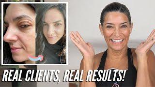 All Natural Anti-Aging Skin Transformation! | Natural Skincare Routines