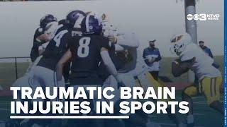 Traumatic brain injuries in sports: What's being done to protect athletes