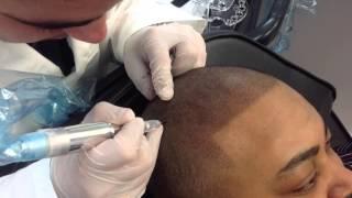 Hair tattoo pigmentation procedure