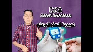 DKA / غيبوبة السكر المرتفع