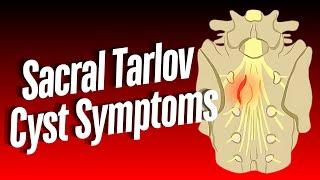 Sacral Tarlov Cyst Symptoms: Insights from 100 Patients