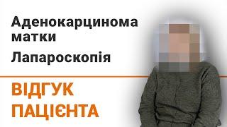 Аденокарцинома матки. Лапароскопія - відгук пацієнтки клініки Добрий Прогноз