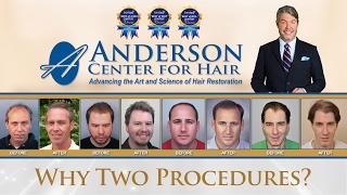 Why Two Procedures? - Anderson Hair Center