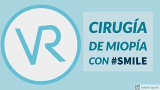 ¿Cómo se corrige la MIOPÍA? La técnica SMILE