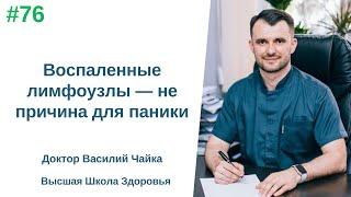 #76 Воспаленные лимфоузлы — не причина для паники. Спросите у доктора Василия Чайки