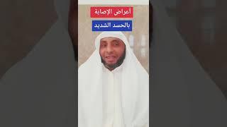 أعراض تدل على الحسد الشديد