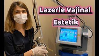 Lazerle Vajinal Estetik /Monalisa Touch #kudreterkenekli #vajinalestetik #monalizatouch