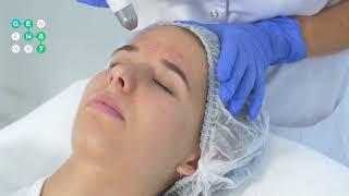 DERMADROP TDA МЕЗОТЕРАПИЯ БЕЗ УКОЛОВ | Cеть клиник косметологии GEN87