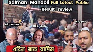 सलमान भाई  की  दवाई 4दिन में बाल बापिस ।Hair Loss Alopeciya Hair Fall Result Ya Scam #salmanmandoli