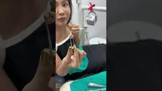 รีวิว ถอนฟันผุ เคลียร์ช่องฟันก่อนจัดฟันรอบสอง Dent Define clinic | ทิวลิป กัญญาภัค | tulip kunyapak