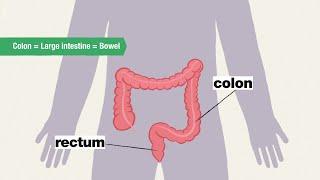 What is a colonoscopy and why do I need one?