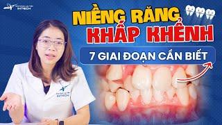 7 Giai Đoạn Niềng Răng Khấp Khểnh Phải Biết Trước Khi Chỉnh Nha