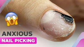 Transforming Damaged Nails | Iridescent Chrome Powder Nails