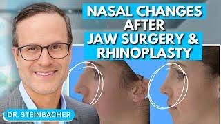 Nasal Changes After Orthognathic Jaw Surgery and Rhinoplasty | Dr. Derek Steinbacher