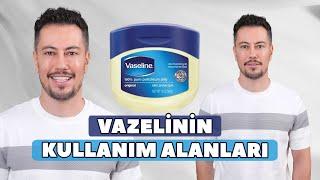 Vazelinin Kullanım Alanları