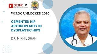 WIROC UNLOCKED 2020 : Cemented Hip Arthroplasty in Dysplastic hips - Dr. Nikhil Shah