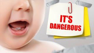 MY BABY HAS GRAY INFANT TEETH.. WHAT TO DO?! (Oral Health and Dentistry)