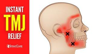 How to Relieve TMJ Pain at Home | 30 SECOND RELIEF