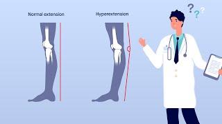 Multiple structures involved in preventing knee hyperextension