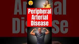 Improve the symptoms of Peripheral Arterial Disease with carnivore. #pad #arteryhealth