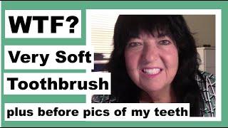 My Very Soft Toothbrush plus Before Pics of My Teeth