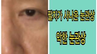 팔자가 사나운 눈관상(악한 눈관상)