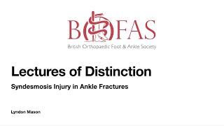 BOFAS Lecture of Distinction - Syndesmosis Injury in Ankle Fractures